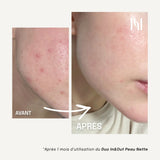 HOLITE: Complément Alimentaire Liquide Visage Peau nette